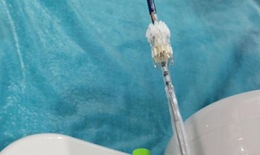 KIMS Becomes First Hospital in Odisha to Conduct TMVR to Repair Heart Valve : Ommtv