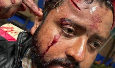 ସାମ୍ବାଦିକଙ୍କୁ ହତ୍ୟା ଉଦ୍ୟମ ରହସ୍ୟ... କର୍ପୋରେଟର ପୁଅ ମୁଖ୍ୟ ଚର୍ଚ୍ଚା  ପୁଲିସ୍ ଚାପଶୂନ୍ୟ ହେଲେ ସତ୍ୟାସତ ବାହାରିପାରିବ : Ommtv